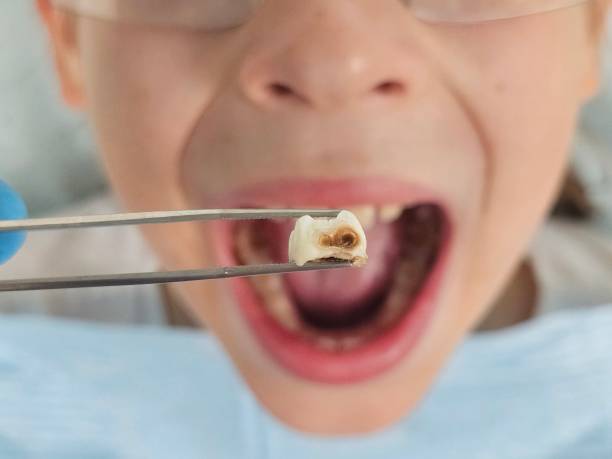 Best Walk-In Emergency Dentist in Renovo, PA